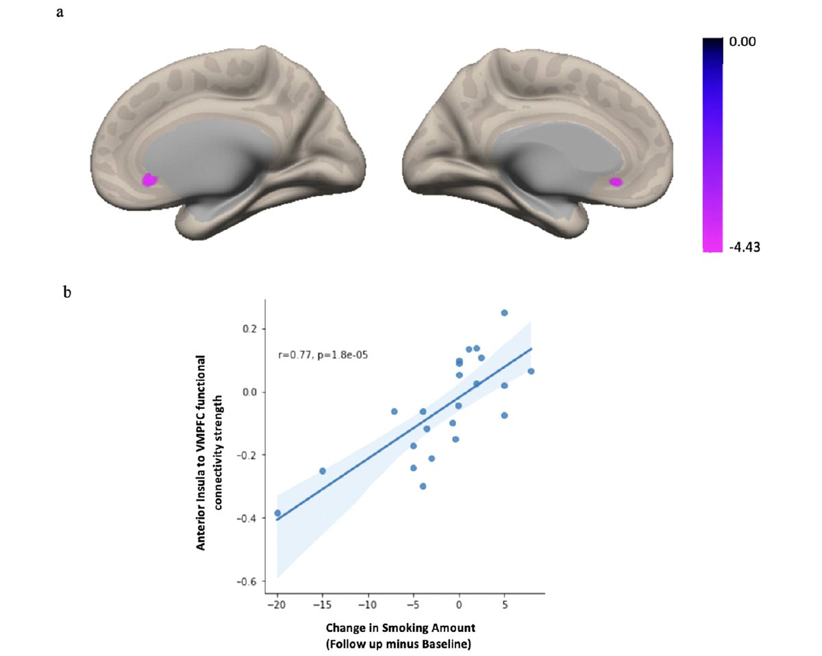 New paper in Imaging Neuroscience by Nagashree Thovinakere, Maiya R. Geddes, et al: Ventromedial frontoinsular connectivity is associated with long-term smoking behavior change in aging doi.org/10.1162/imag_a…