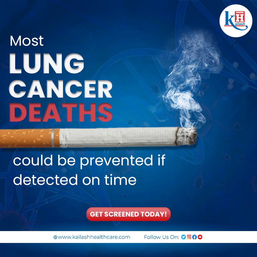 Diagnosing #LungCancer early means more treatment options & a higher chance of beating it. Talk to your doctor about #cancerscreening if you're at high risk.

Consult our Chest Physicians : kailashhealthcare.com

#EarlyDetectionSavesLives #LungCancerAwareness