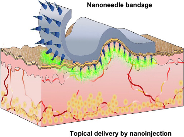 Discover how nanoneedles are transforming medical devices! New research by @ChiappiniLab, @CongW5 at @CCRB27 explores embedding nanoneedles for precise drug delivery and biosensing. Read it here 🔗 go.acs.org/9kw