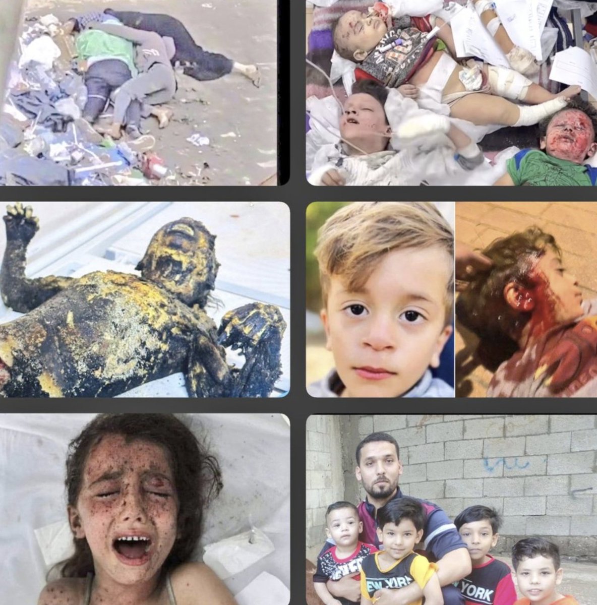 Gaza Genocide 💔 
#GazaHoloucast #FreePalaestine