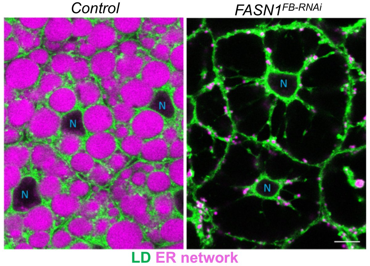 Excited to share this preprint from collab with @RJDLab and @thomaspmathews.

Here we dissect how fat and carbohydrate energy stores are sensed & balanced. We also identify a novel cytokine that senses fat depletion & regulates energy homeostasis. 

biorxiv.org/content/10.110…