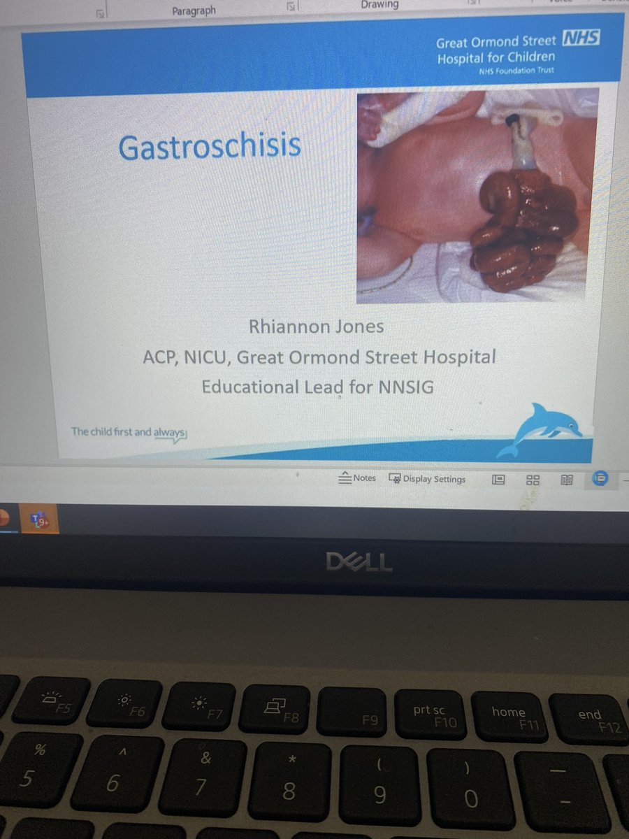Despite the technical hiccup, the gastroschisis webinar went really well. Thank you so much to all the expert speakers for the excellent, informative talks. Great examples of best practice standards shared. #gastroschisis #bestpractice #neonatalsurgery
