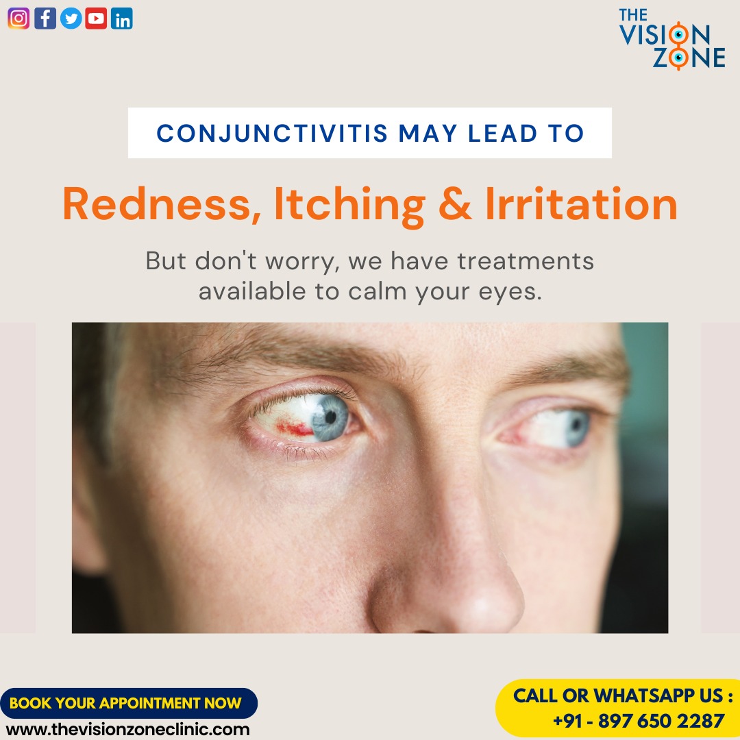 Red eyes? Relief's here! 
Beat conjunctivitis discomfort with our soothing treatments!

Schedule your appointment today.
Call or WhatsApp us: 089765 02287

#thevisionzone #conjunctivities #eyeredness #eyeitching #eyesafety #eyeproblem #clearsight #vision #treatmentavailable