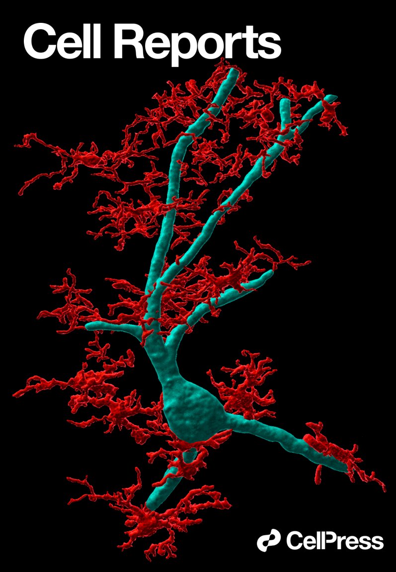 In 2022, we published our first study about developing a new monkey model of #COVID19. The image below is a 3D reconstruction of a microscopy image showing microglia cells (🔴iba1) attacking a neuron (🔵neurofilament) infected with SARS-Cov-2 (not shown). Do you want to see more?