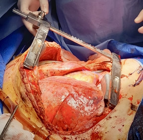 Germán Fortunato, MD tweet media