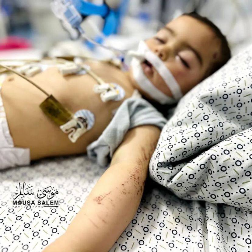 7 month old Samira Qibit is the only survivor of her family after the bombing of her family home in Beit-Lahia, Northern Gaza.