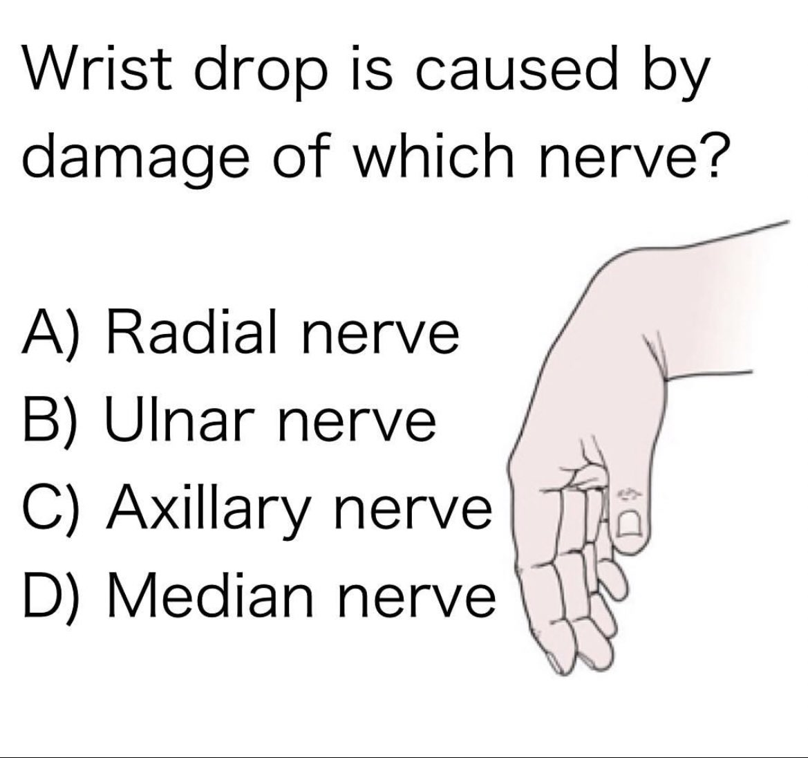 Wrist drop is caused by damage of which nerve?