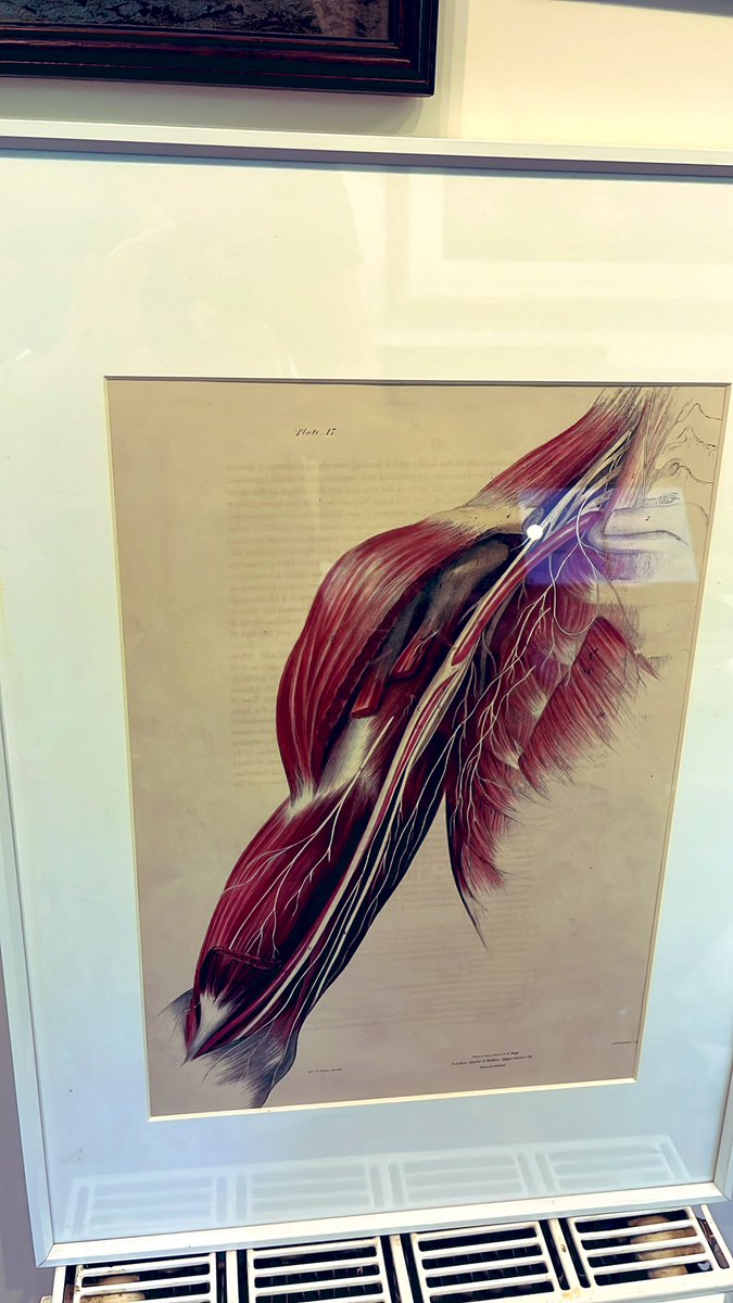 TJQPNI's tweet image. A really wonderful gift of from a colleague now framed and soon to be on my wall. 
#brachialplexus #nervenerd #anatomy #dissection