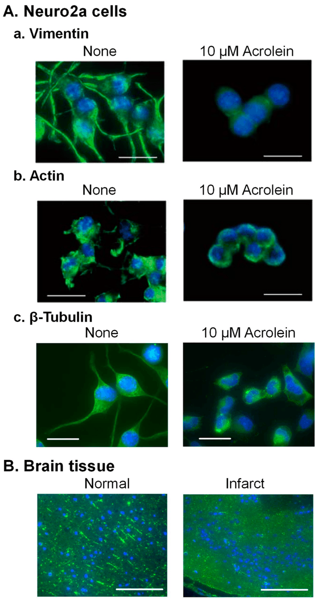 #HighlyCitedPaper
 
Read now ➡️ 'Molecular Characteristics of Toxicity of Acrolein Produced from Spermine' by  Keiko Kashiwagi and Kazuei Igarashi. 

👉 brnw.ch/21wJLMd