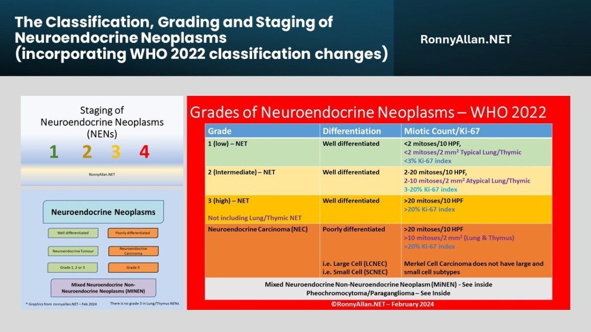 The Classification, Grading and Staging of Neuroendocrine Neoplasms (incorporating WHO 2022 classification changes) buff.ly/43eAVq9