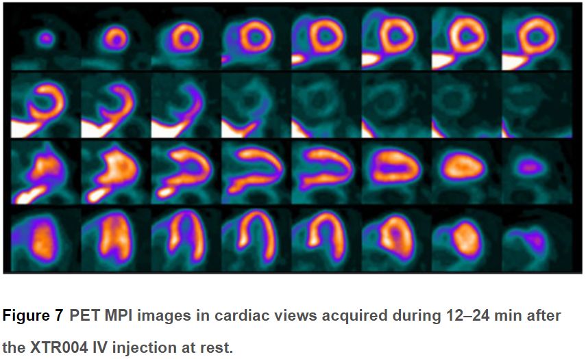 XTR004: a novel 18F-labeled PET MPI tracer that carries a favorable safety profile with rapid, high, and stable myocardial uptake for imaging. Editorial by Rene Packard @dgsomucla Read here👉bit.ly/4anzBU7 #CVNuc @MyASNC