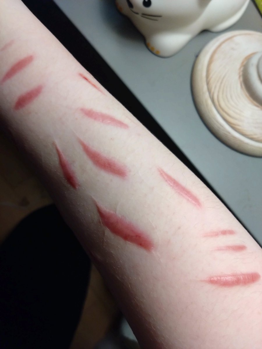 i dont think i ever showed the scars