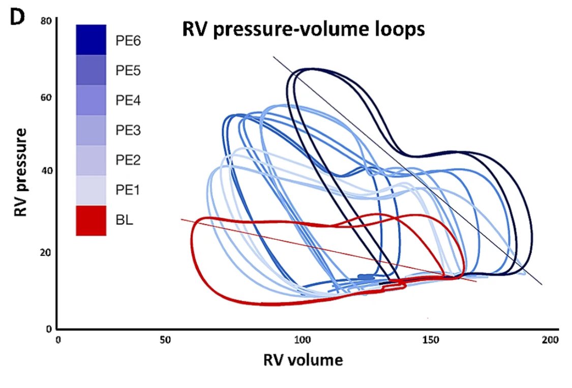 What happens minutes after the acute #PE strikes? Cardiorespiratory parameters react differently to increased clot burden bmcpulmmed.biomedcentral.com/articles/10.11… #PVloops #peoplesventricle #hemodynamics🫀🫁🐷 @DocAsger @Jacob_G_Schultz @Anders_K_H @CSMortensen @Nielsen_Kudsk