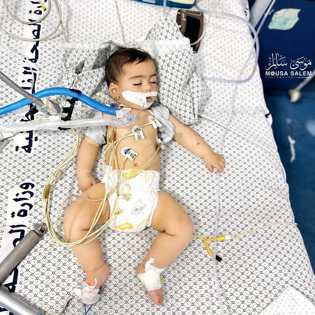PALESTINE🇵🇸🏳️🕊️ The baby girl Samira Qibt (7 months) is the only survivor of her family after the bombing of her family home in Beit Lahya north of Gaza. By @mousa_salem__
#GazaGenocide #Palestine #IsraeliTerrorism #HamasIsResistance #IsraelNewNazi #IsraelISIS #Israelrapist