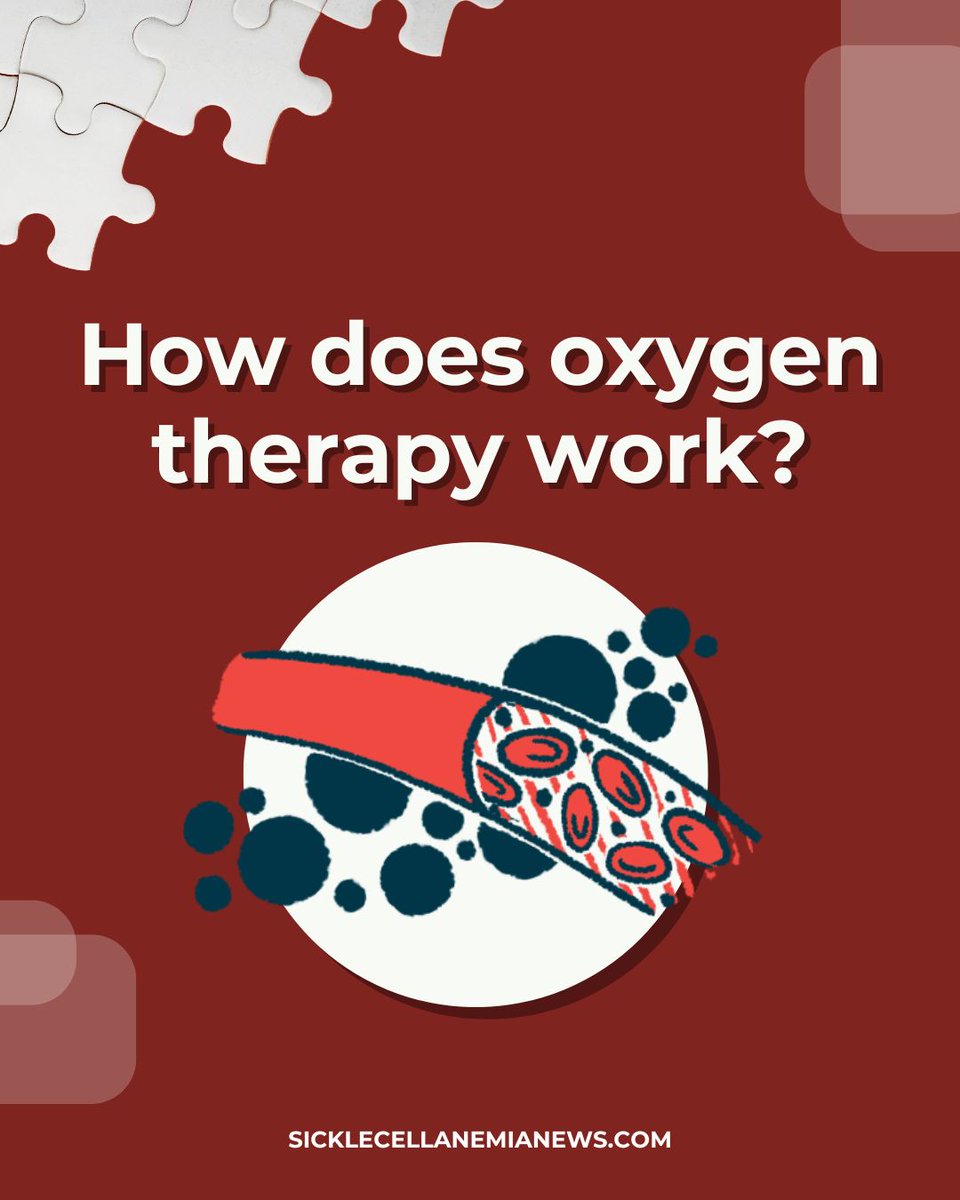 The use of oxygen therapy in sickle cell disease is controversial. Learn when it should and should not be used: buff.ly/3WGaqIX #OxygenTherapy #SickleCell #SickleCellAnemia #SickleCellDisease #SickleCellEducation