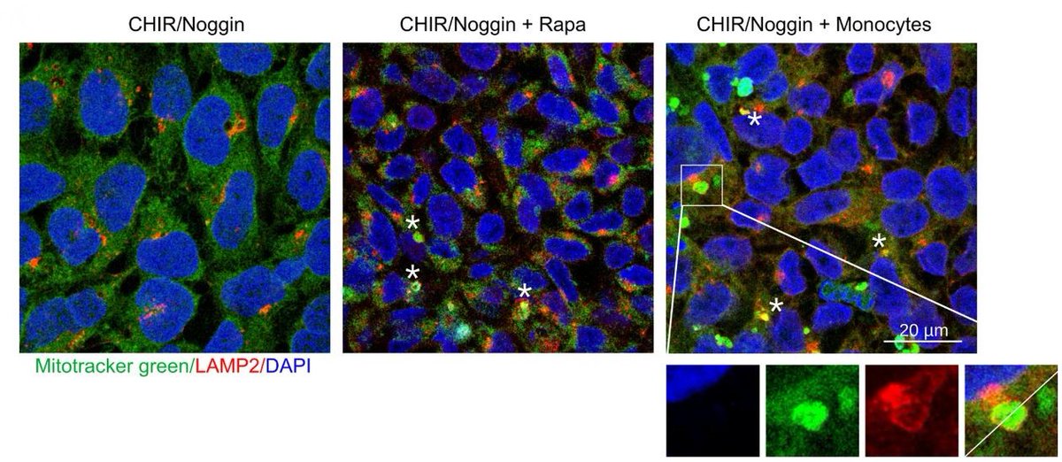 Scientists observed that CHIR induced apoptosis of #iPSCs during the initial stage of renal 🧫 #organoid differentiation. Underlying mechanisms implied the accumulation of reactive oxygen species and 📉 decreased #autophagy. 📖 bit.ly/3JWgfdT