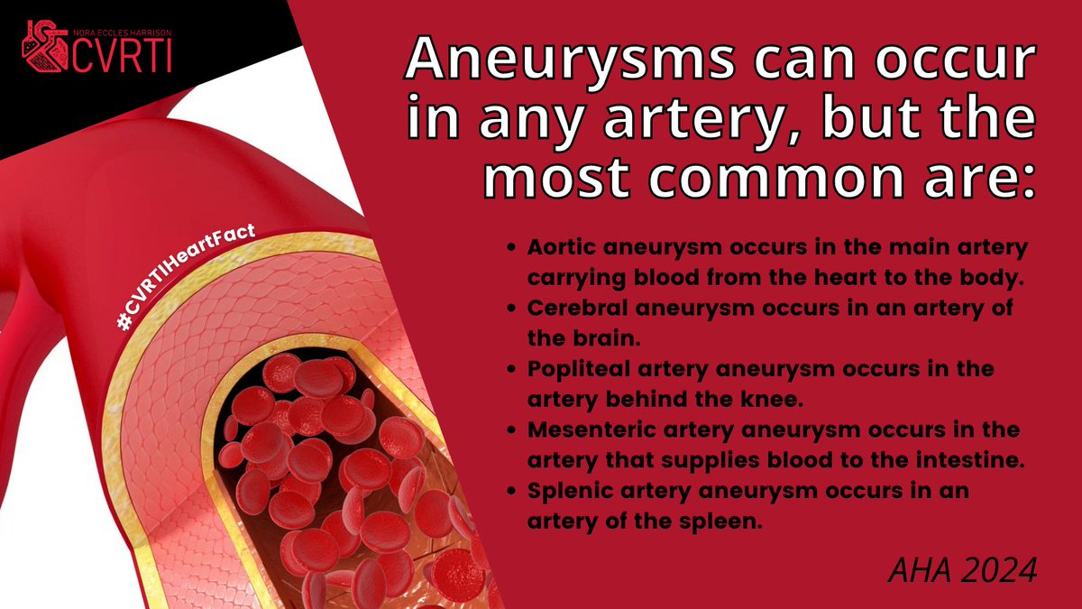 What are the most common kinds of #aneurysms? 🤔
While this condition can happen in any artery, some are more common than others. Learn more below!

#hearthealth #cardiovascular #research #cardiovascularresearch #cardiovascularhealth #heartdisease #utah #CVRTIHeartFact