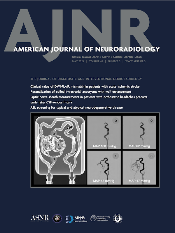 Rodrigo Rivera (@neurofox) on Twitter photo Thanks <a href="/TheAJNR/">AJNR</a> for putting our work on the cover of this month edition! We are so proud 🙌🏽
bit.ly/44I7uxw
<a href="/aymeric87/">aymeric rouchaud</a> <a href="/jpcruz81/">Juan Pablo Cruz</a> <a href="/Qisa3D/">Qisa3D</a> <a href="/formlabs/">Formlabs</a> @unilim <a href="/NeuroAsenjo/">Instituto de Neurocirugía</a> <a href="/alvaroce73/">Alvaro Cespedes</a> Thanks <a href="/TheAJNR/">AJNR</a> for putting our work on the cover of this month edition! We are so proud 🙌🏽
bit.ly/44I7uxw
<a href="/aymeric87/">aymeric rouchaud</a> <a href="/jpcruz81/">Juan Pablo Cruz</a> <a href="/Qisa3D/">Qisa3D</a> <a href="/formlabs/">Formlabs</a> @unilim <a href="/NeuroAsenjo/">Instituto de Neurocirugía</a> <a href="/alvaroce73/">Alvaro Cespedes</a>