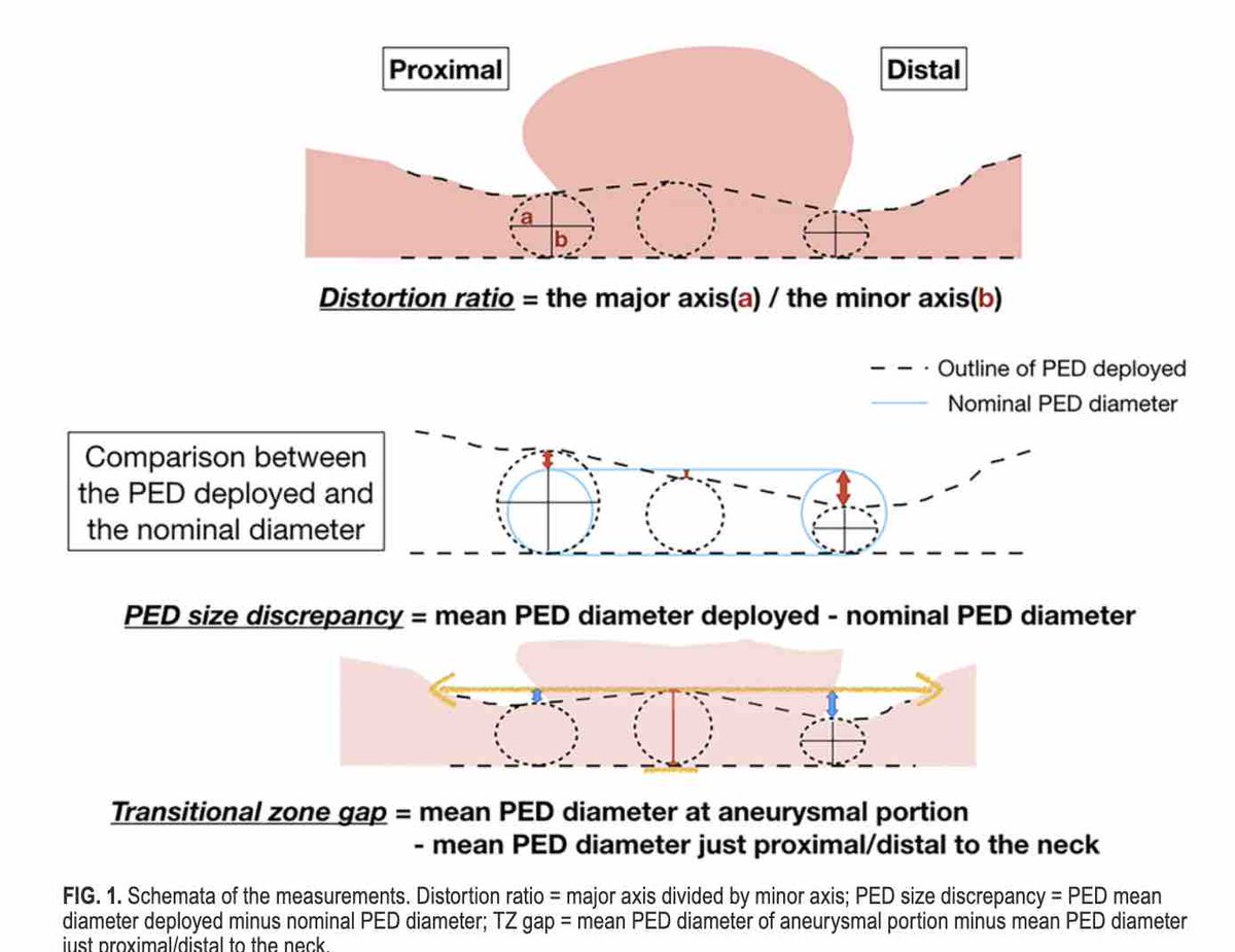 Pipeline embolization device dynamics: prediction of incomplete occlusion by elongation from nominal length. thejns.org/view/journals/….