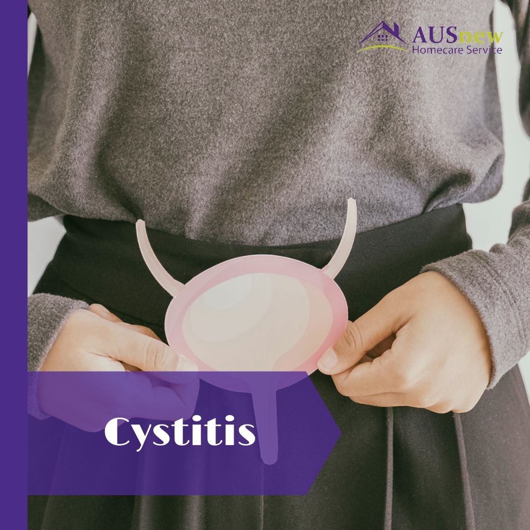 🔸Cystitis is the medical term for bladder inflammation (sis-TIE-tis). Inflammation is characterised by a hot and distended body part. Additionally, it may be excruciating. Source: Mayo Clinic #cystitis #bladderinflammation