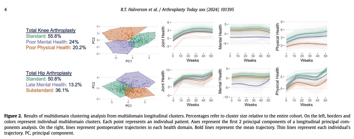 Ryan Halvorson, MD (@ryanhalvorson80) on Twitter photo How many patients actually have a "normal" recovery after hip and knee replacements?
New study with <a href="/spinesinspace/">Jeannie Bailey, PhD</a> et al. looks to answer this question and identify patients at risk for suboptimal recovery.
authors.elsevier.com/sd/article/S23… How many patients actually have a "normal" recovery after hip and knee replacements?
New study with <a href="/spinesinspace/">Jeannie Bailey, PhD</a> et al. looks to answer this question and identify patients at risk for suboptimal recovery.
authors.elsevier.com/sd/article/S23…