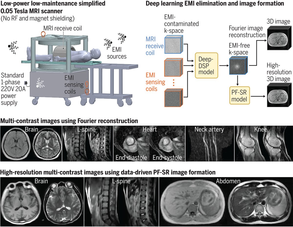 In a new Science study, researchers present a safer, low-cost, and low-energy whole-body MRI device. The findings could help address unmet clinical needs in diverse healthcare settings worldwide. scim.ag/6Xh