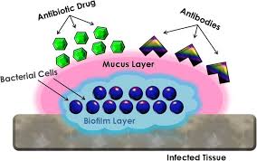 What may be preventing your gut from healing? 

It may be from biofilm

Biofilms can be impenetrable by antibiotics or immune cells, can increase inflammation, and dictate the environment of the gut. 

Like plaque in your teeth, they are a hardened structure made out of a matrix