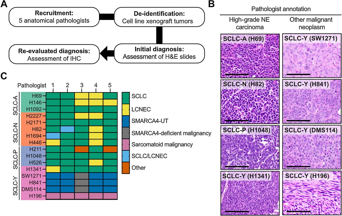 Molecular and Pathologic Characterization of YAP1-Expressing Small Cell Lung Cancer Cell Lines Leads to Reclassification as SMARCA4-Deficient Malignancies. bit.ly/3yhfMk2