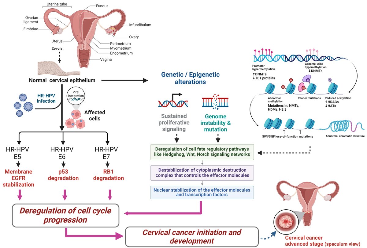 OAE_JCMT's tweet photo. Crosstalk between cell fate and survival pathways during #uterine #cervical #carcinoma progression: a #molecular and #clinical perspective
Online: https://t.co/3g2ugJmIHi
PDF: https://t.co/fNf2w1DnmE https://t.co/sfnU7oQYqq