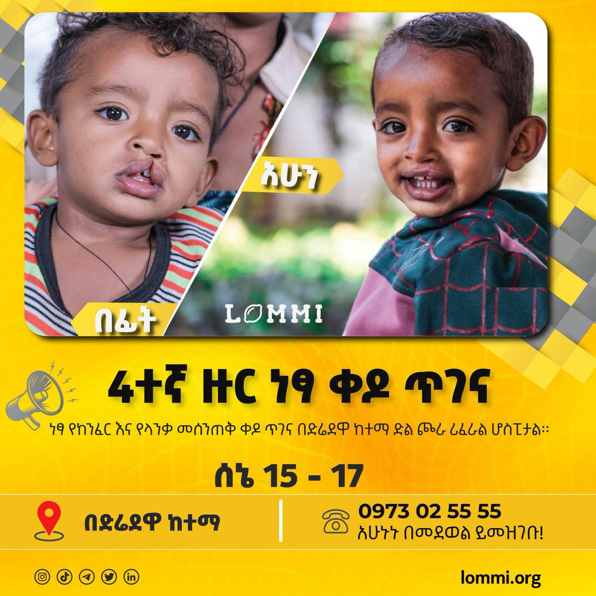4ተኛ ዙር ነፃ ቀዶ ጥገና በድሬደዋ ከተማ ሊጀመር ነው!!!

በድሬደዋ ከተማ ድል ጮራ ሪፈራል ሆስፒታል ከሰኔ 15 - 17 የከንፈር እና የላንቃ መሰንጠቅ ቀዶ ጥገና የሰጣል።

ለመመዝገብ☎️☎️☎️ 0973025555 ላይ ይደወሉ!

🍋 🍋 🍋
lommi.org