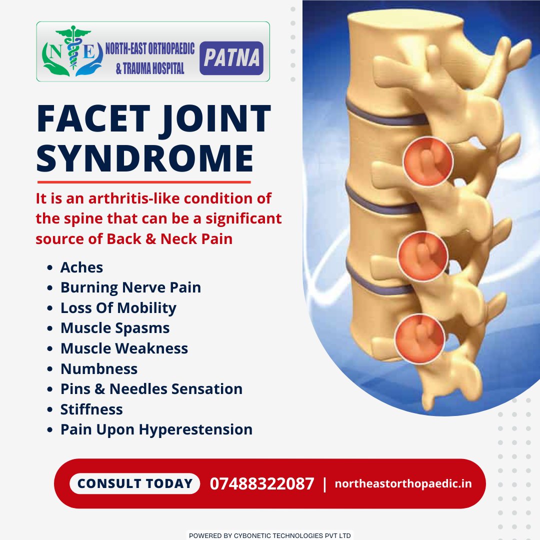 Dealing with persistent back or neck pain? You might be facing Facet Joint Syndrome – a condition akin to arthritis affecting the spine. Don't let discomfort hold you back!

Book an Appointment:
☎+91-74883-22087
🌐northeastorthopaedic.in

#FacetJointSyndrome #BackPain #NeckPain