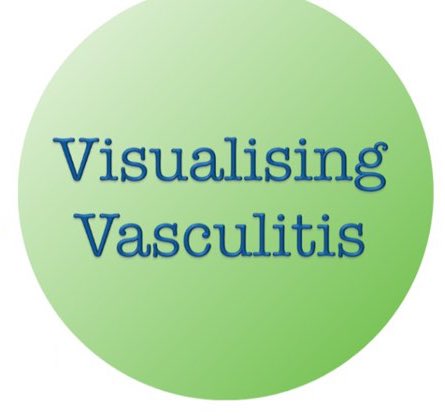 #VasculitisAwarenessDay Wednesday, May 15th #Vasculitis a rare #rheumatic #autoimmune disease - 20 different types, each type extremely rare in its own right. vasculitis.org.uk/about-vasculit… #VisualisingVasculitis - our campaign is to support #patients & #Research justgiving.com/campaign/visua…