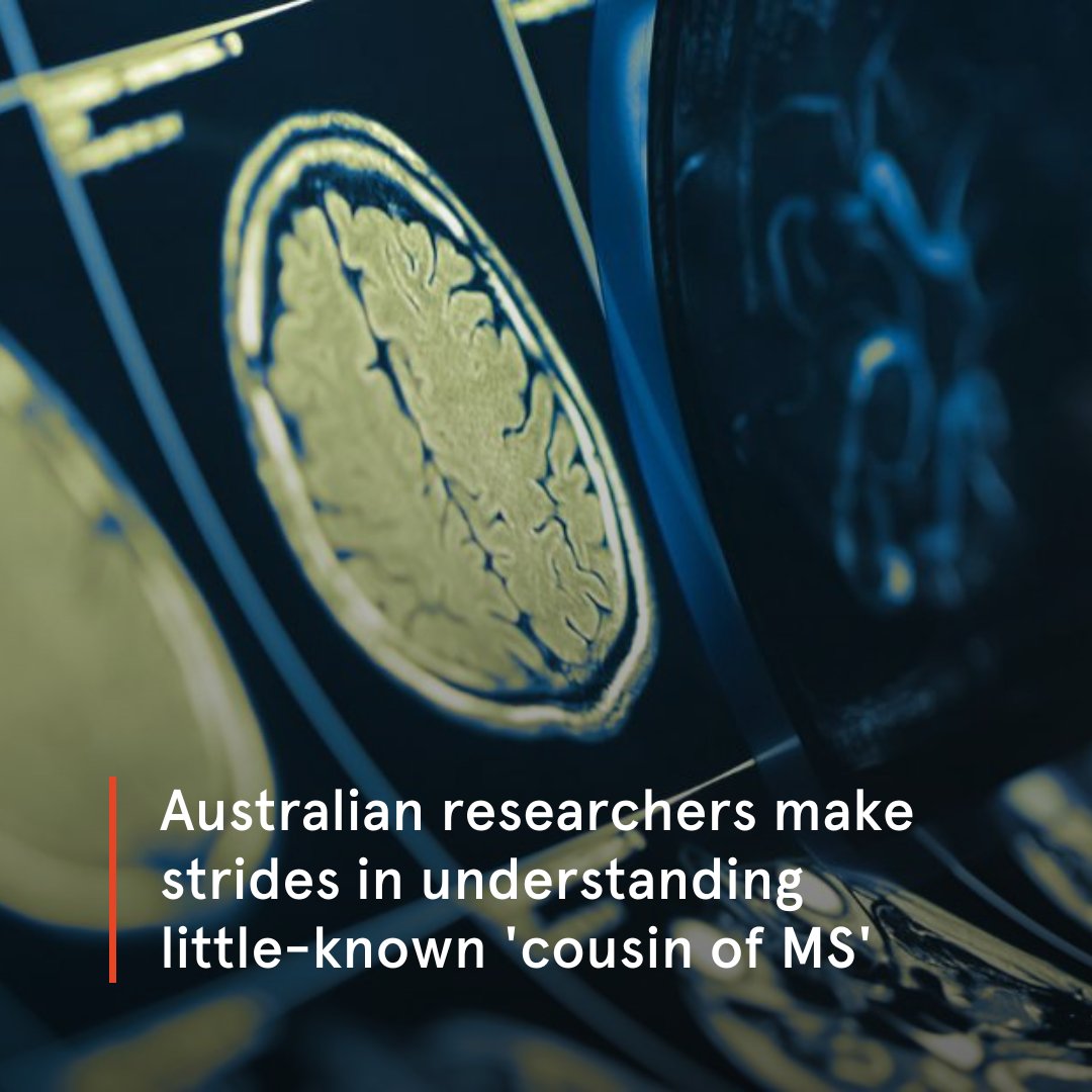 A team of over 50 Australian scientists, headed by Prof @FabienneBrilot from @Sydney_Uni & Kids Neuroscience Centre at @SCHNkids, have discovered a way to predict a relapse course in little-known disease Myelin oligodendrocyte glycoprotein antibody disorders (MOGAD).