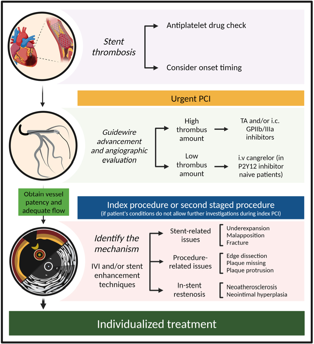 Vessel Plus (@vessel_plus) on Twitter photo #CoronaryStentThrombosis #PCI
🌈Despite advancements in antiplatelet medications and drug-eluting stent (DES) technology, ST remains associated with considerable morbidity and mortality.
📒Article from Prof. <a href="/BURZOTTA_F/">FRANCESCO BURZOTTA</a> 's team👇 oaepublish.com/articles/2574-… #CoronaryStentThrombosis #PCI
🌈Despite advancements in antiplatelet medications and drug-eluting stent (DES) technology, ST remains associated with considerable morbidity and mortality.
📒Article from Prof. <a href="/BURZOTTA_F/">FRANCESCO BURZOTTA</a> 's team👇 oaepublish.com/articles/2574-…