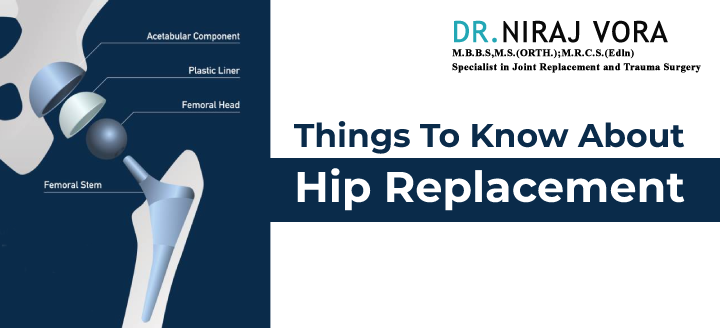 Things to Know About #HipReplacement | #DrNirajVora The entire procedure of total hip arthroplasty minimally invasive is a crucial one, and you need to be acquainted with pre and post-surgical means.. Know more at: drnirajvora.com/blog/things-to…