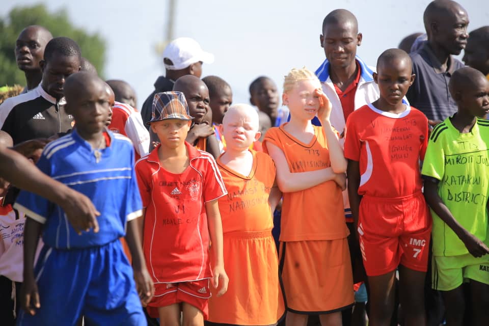#UPSSAAthletics2024 'Disability is not inability' The albinos are also taking part in the 60m race at Kitgum Boma ground