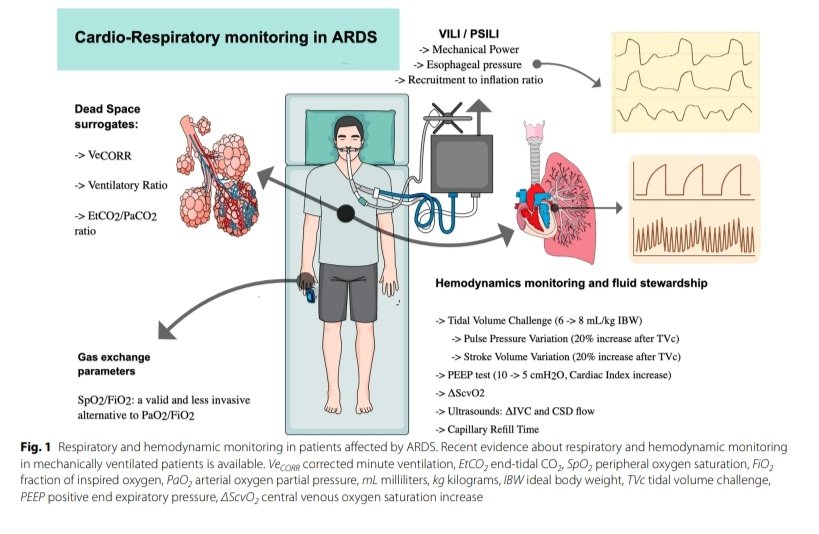 🫀Avances en la Monitorización Cardiorrespiratoria en Pacientes con SDRA 🫁

🔰📚Journal of Intensive Care 2024

doi.org/10.1186/s40560…

Enlace a Artículo Completo 👇🏼✅🆓t.me/SoMELaguna