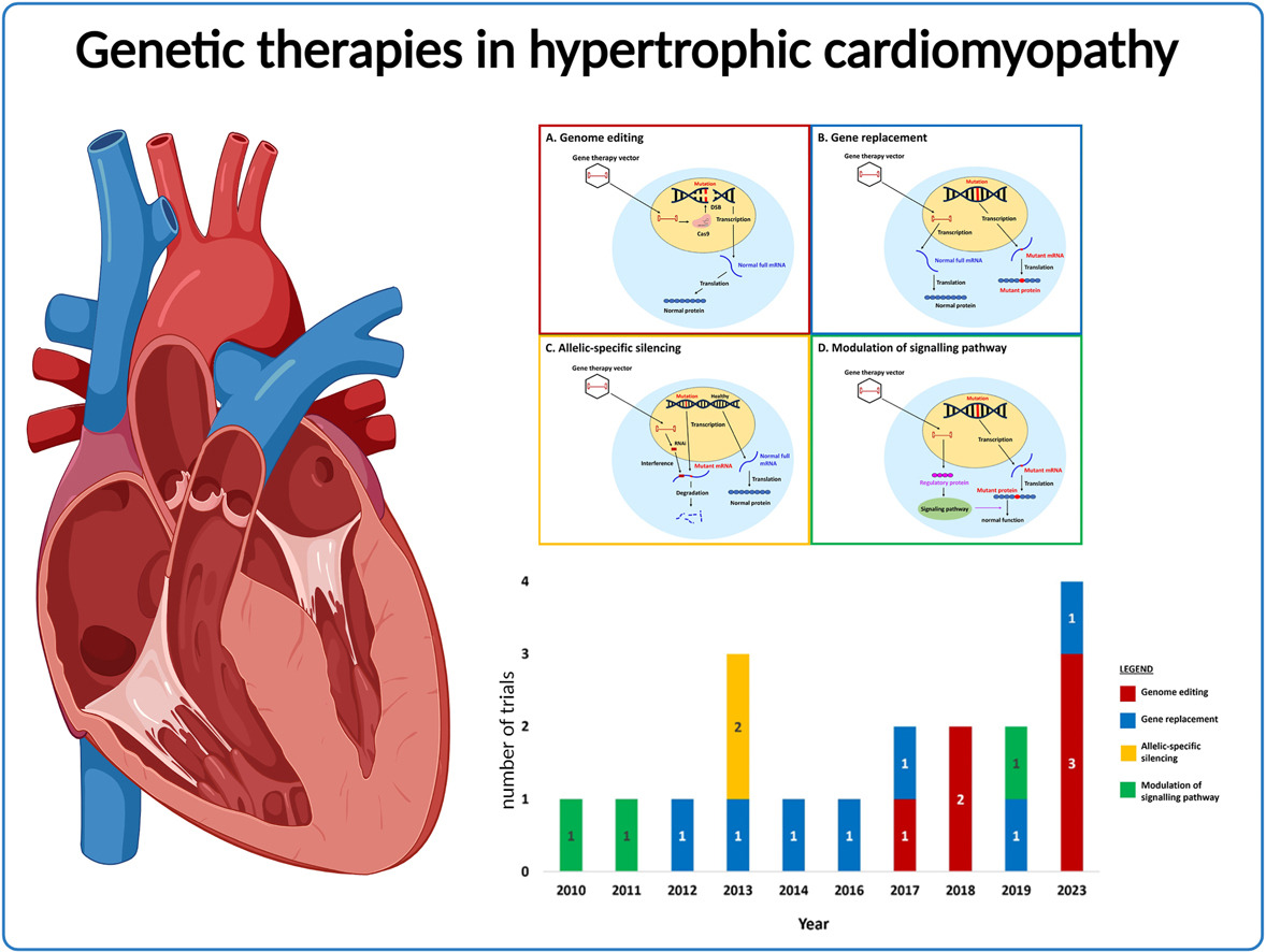 Hypertrophic cardiomyopathy (#HCM) is the most common #genetic #cardiomyopathy and may cause sudden #cardiac death. Do new and emerging genetic therapy platforms offer the prospect of cure? Read more here 👉 onlinecjc.ca/article/S0828-… #CJC