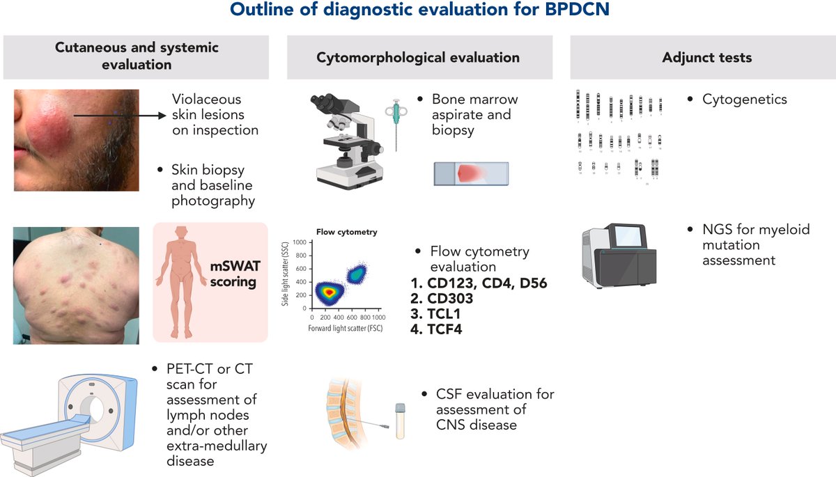 North American Blastic Plasmacytoid Dendritic Cell Neoplasm Consortium: position on standards of care and areas of need [Feb 9, 2023] @doctorpemm et al. @lane_andy @BloodJournal ashpublications.org/blood/article/… #BPDCN