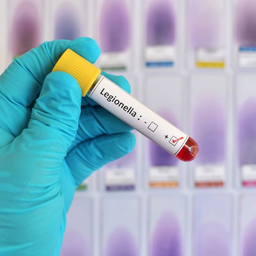 Legionnaires' disease can thrive in water systems aboard ships. This fact underscores the necessity for using advanced cleaning and sanitising solutions designed to effectively combat and prevent the growth of harmful bacteria.

Find out how we can help: rsecoworld.com/contact/