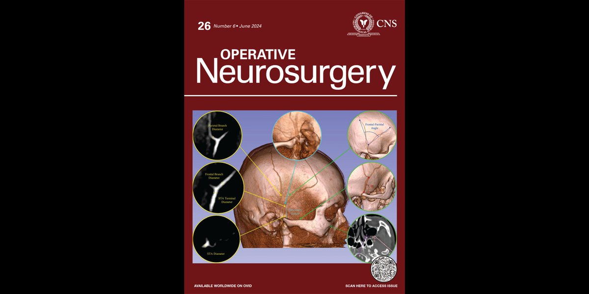 #ONSNewIssue is here bit.ly/3KFHM44 Cover: The Temporoparietal Fascia Flap Transposition Technique for Ventral Skull Base Reconstruction: Anatomic Analysis & Surgical Application #ONSReview Intradural Pituitary Hemitransposition: Technical Note & Case Series Illustration