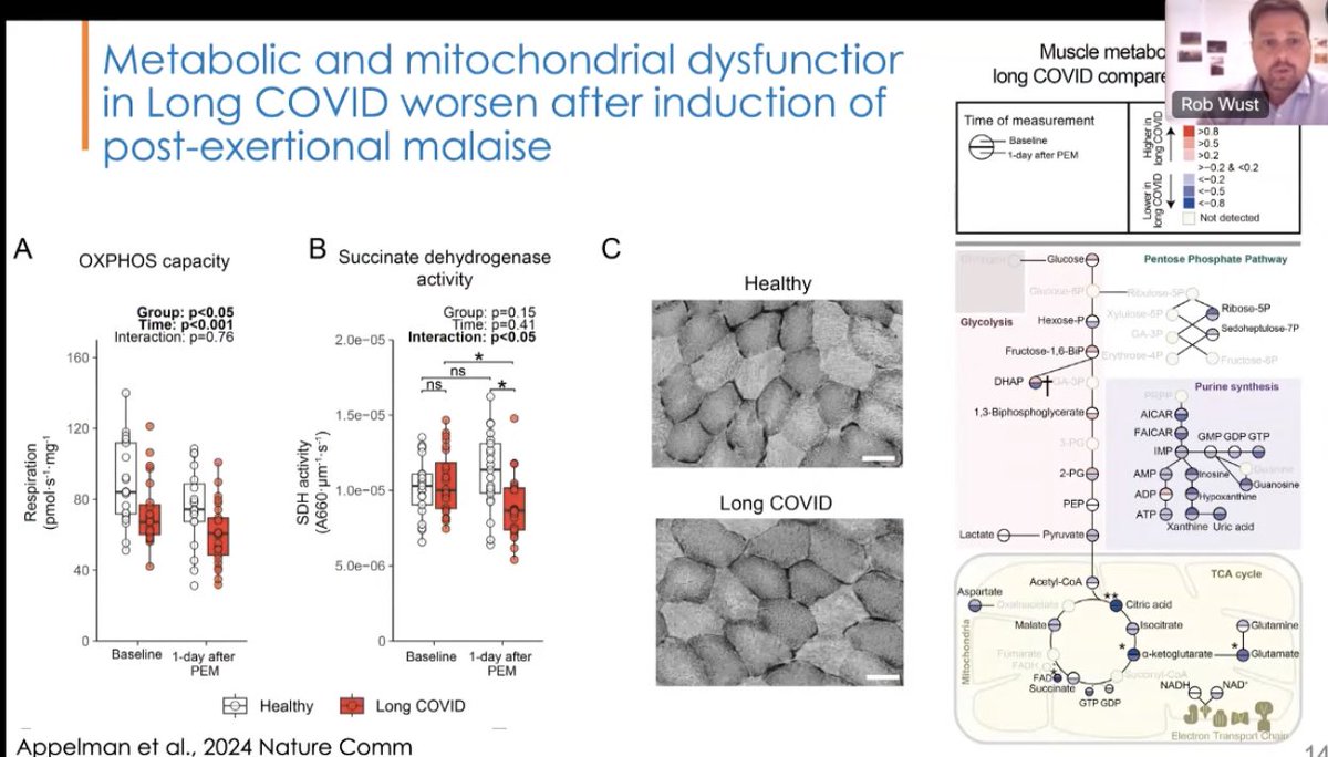 The excellent @RobWust at #UniteToFight2024: “On average, p/w #LongCovid had… faster fatigable muscle fibres… so we focussed on the energy production and mitochondrial function…also worsened 1 day after induction of PEM”