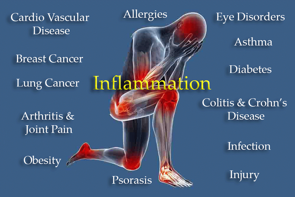 rangebased's tweet image. Chronic inflammation -the sillent killer-
can be caused by these 7  factors:

And what to do for prevention

bookmark this 

1# Poor Diet: 

- Diets high in ultra processed foods
- refined carbohydrates
- PUFA Seed oils (Sunflower, Canola, Soybean etc.) 

+ aim for whole foods…