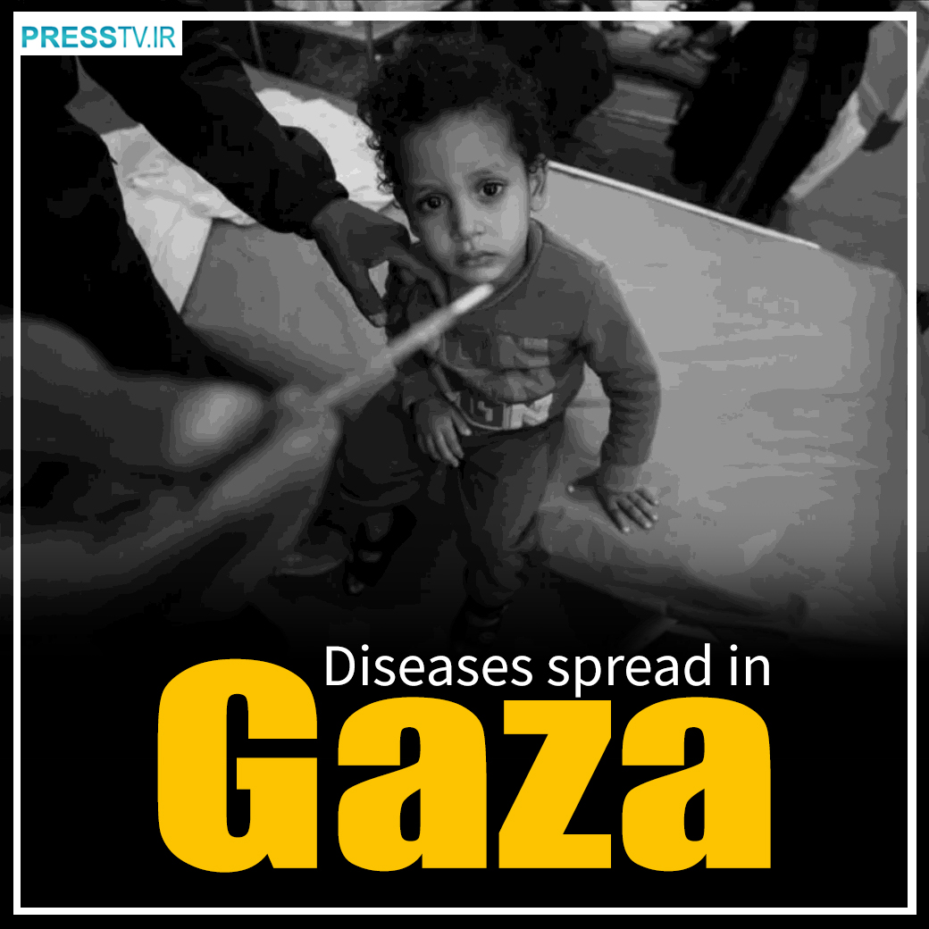 Around 1,095,000 Palestinians have contracted infectious diseases as a result of the displacement caused by over 220 days of Israeli onslaught on Gaza, the Government Media Office in Gaza said. Follow Press TV on Telegram: t.me/presstv