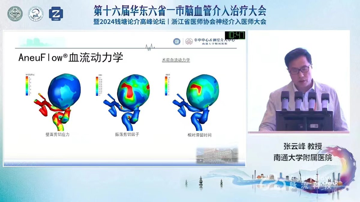 PhdXiang's tweet photo. CFD, computational fluid dynamics, and color for doctors! Flow visualization helps intracranial aneurysm treatment decision-making and treatment planning! https://t.co/IOE5HIH7Ha