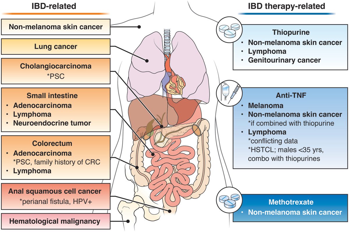 Now published in @AGA_CGH : @AmerGastroAssn Clinical Practice Update on Management of #IBD in Patients with #Malignancy authors.elsevier.com/c/1j5Hd5UiFSkl… Immense thanks to @JHashashMD and #StevenItzkowitz for helping to pull this together!