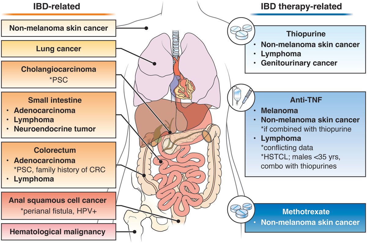 Jordan Axelrad, MD, MPH (@drjordanaxelrad) on Twitter photo Now published in <a href="/AGA_CGH/">CGH</a> : <a href="/AmerGastroAssn/">American Gastroenterological Association (AGA)</a> Clinical Practice Update on Management of #IBD in Patients with #Malignancy
authors.elsevier.com/c/1j5Hd5UiFSkl…
Immense thanks to <a href="/JHashashMD/">Jana G Hashash, MD, MSc</a> and #StevenItzkowitz for helping to pull this together! Now published in <a href="/AGA_CGH/">CGH</a> : <a href="/AmerGastroAssn/">American Gastroenterological Association (AGA)</a> Clinical Practice Update on Management of #IBD in Patients with #Malignancy
authors.elsevier.com/c/1j5Hd5UiFSkl…
Immense thanks to <a href="/JHashashMD/">Jana G Hashash, MD, MSc</a> and #StevenItzkowitz for helping to pull this together!
