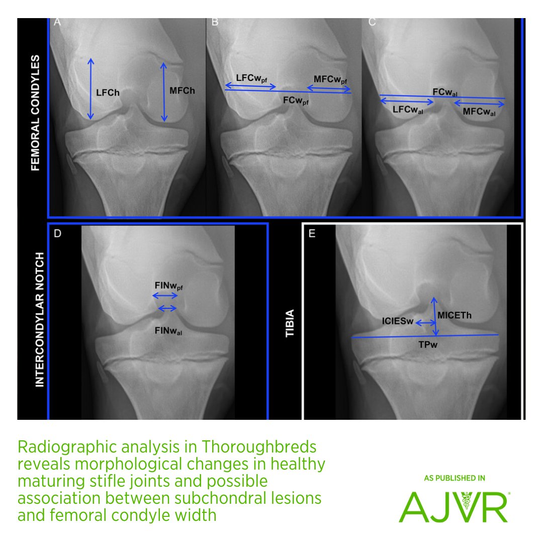 In foals with medial femoral condyle subchondral radiolucencies of the stifle, the distal femur exhibited divergent maturation, indicating a wider medial femoral condyle in the right #stifle in older foals. 🐎 Open access article: jav.ma/sr @theacvr @theacvs #horse