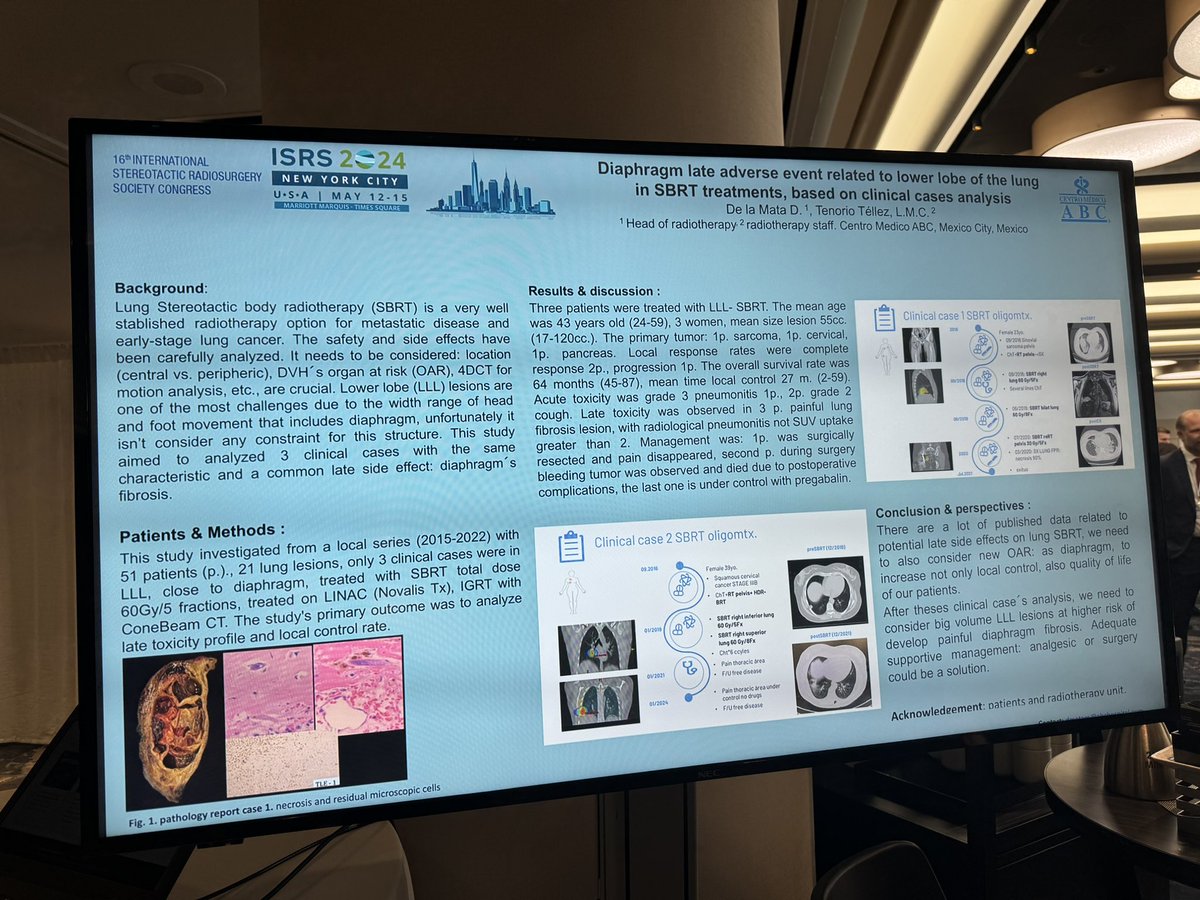 #ISRS2024 presentando experiencia en #SBRT #radiocirugia en #metastasispulmon #lobuloinferior tienen un perfil de toxicidad #dolor asociada a contactar con #diafragma @DrJohnSuh was a great support in #POSTER @ISRSy session