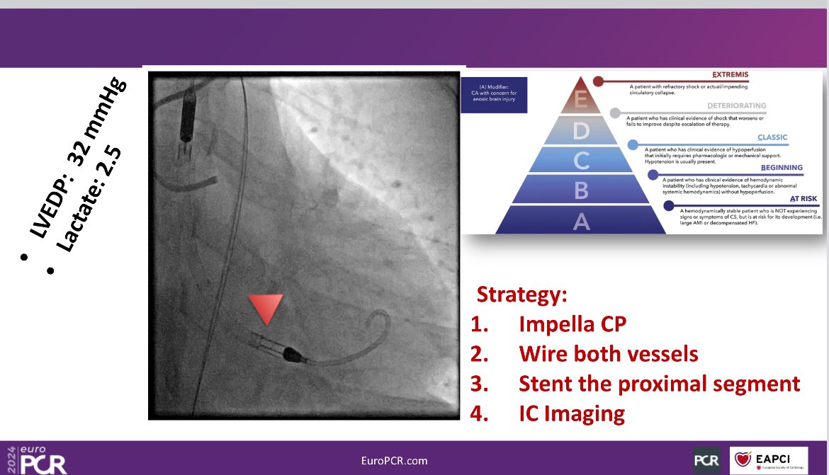 Joint #EAPCI @SCAI session on Cardiogenic shock in women #EuroPCR 🔺Role of MCS 🔺Complete Revascularization 🔺The unknowns of #SCAD Consensus document on the way 📖 @AlexandraLansky @EAPCIPresident @georgedangas